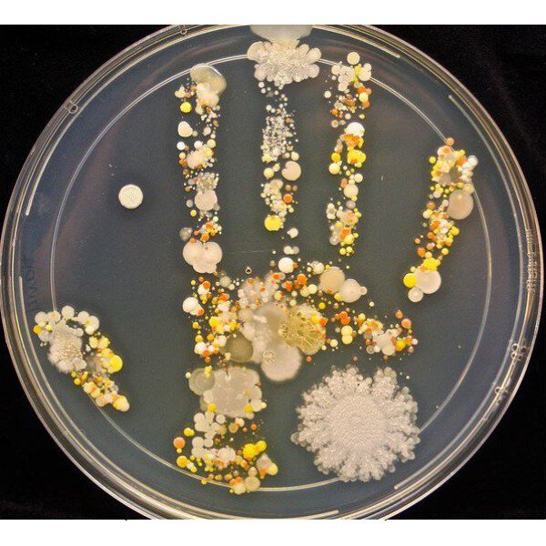5 loài vi khuẩn đáng sợ trên bàn tay bạn